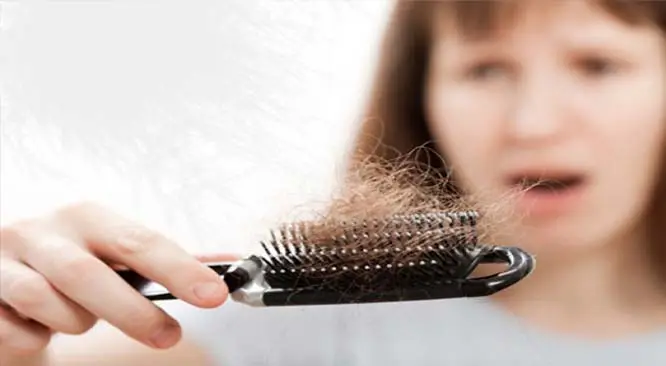 Top Reasons Why Your Hair Is Falling Out? (Part 3)