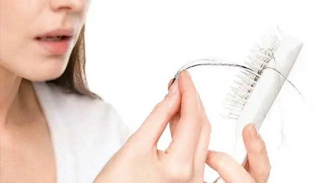 5 Most Common Reasons For Hair Loss In Women
