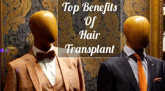 Top Benefits of Hair Transplant Surgery