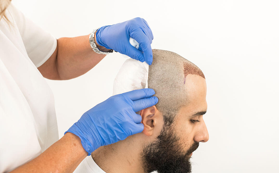 Infected Hair Transplant Symptoms Causes and Treatment