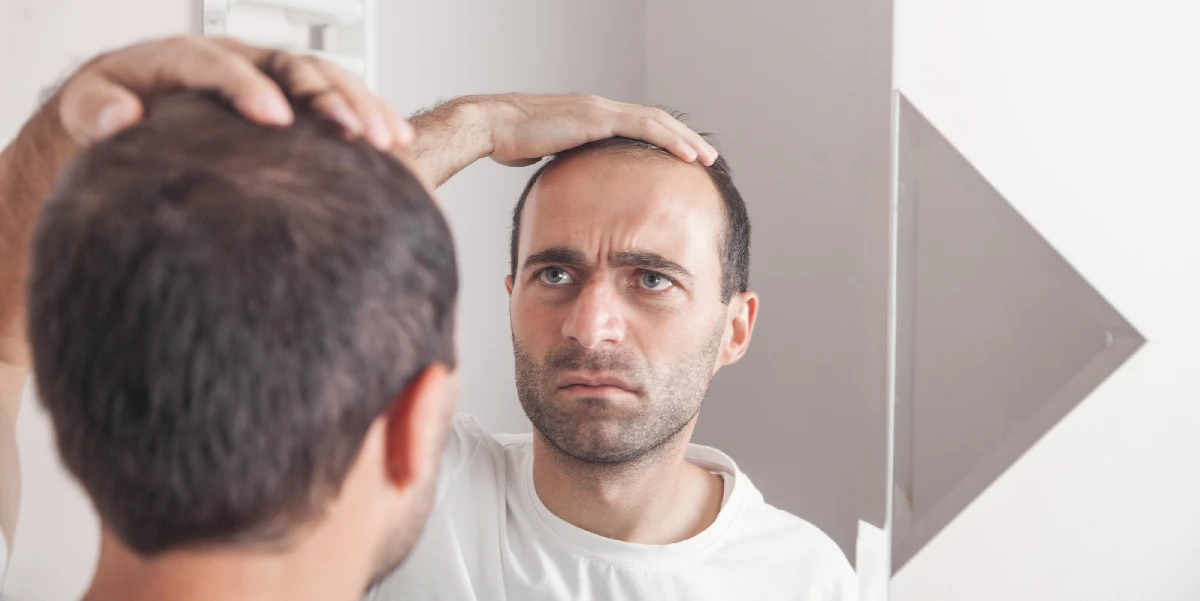 Hair Transplant In Turkey Vs India