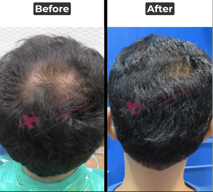 S. C. GFC Results Before and After 